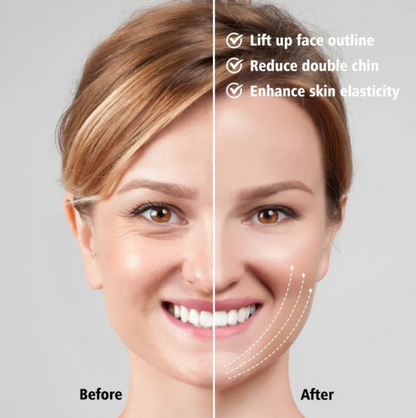 LED V-Lifting Facial Massager